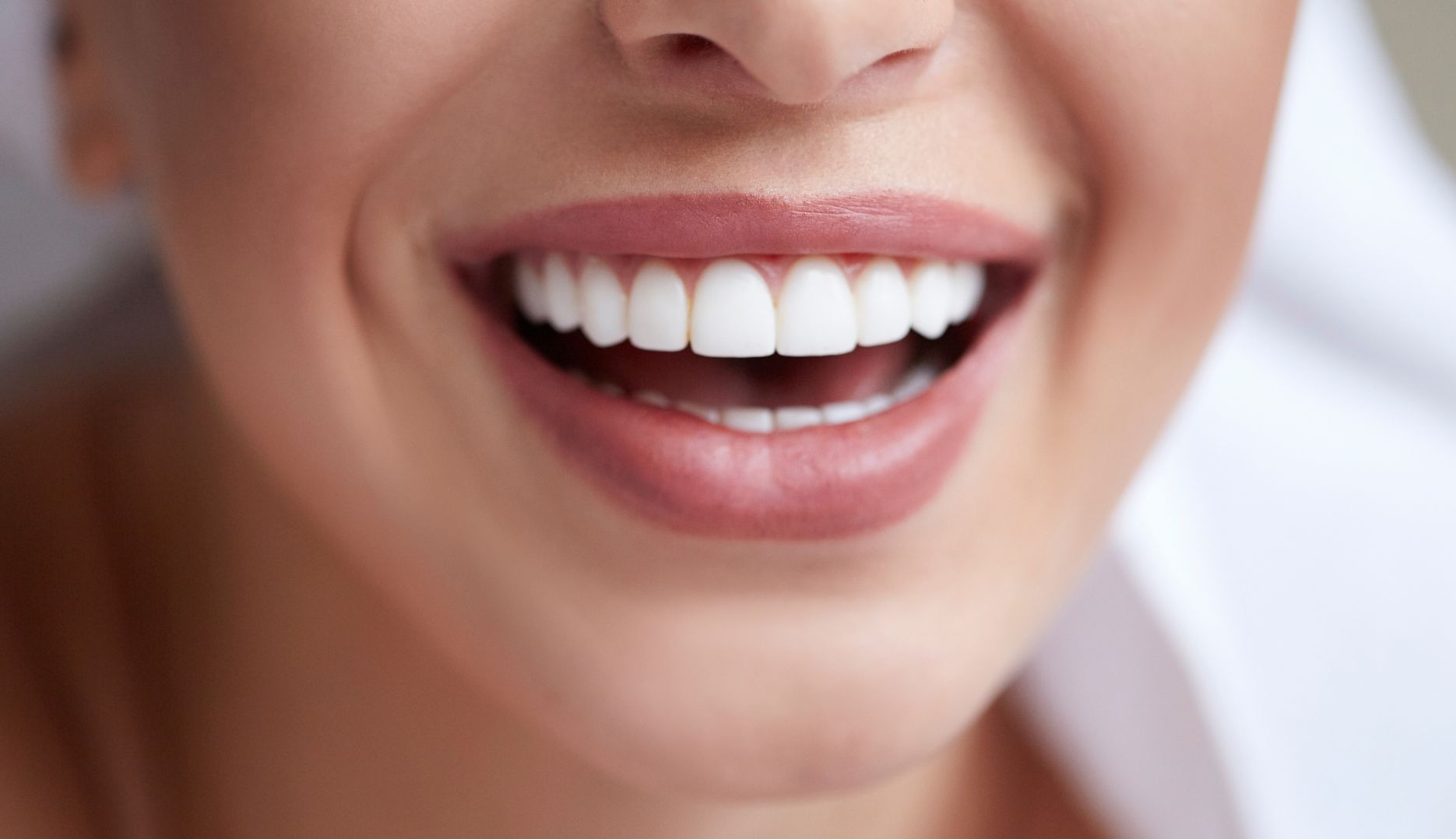 Teeth Whitening - Moray Orthodontics (3)